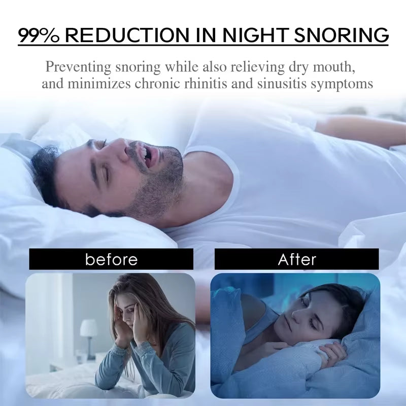 100/50/20Pcs anti Snoring Mouth Tape for Better Sleeping Mouth Strips Reduce Mouth Dryness Medical Grade Nose Breathing Stickers